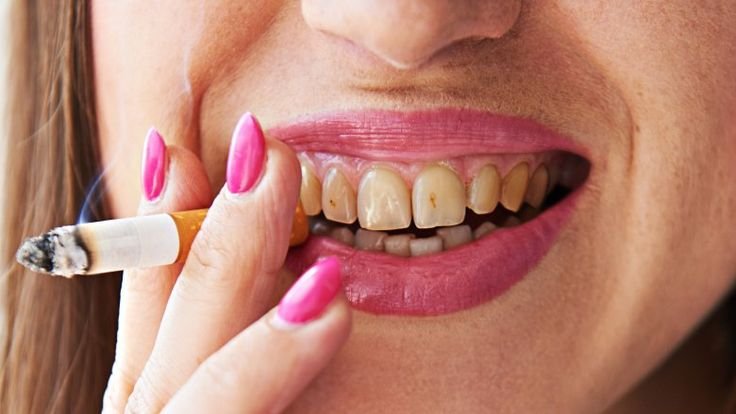 Unhealthy Teeth: 8 Critical Causes Explained Critical Causes Behind Unhealthy Teeth