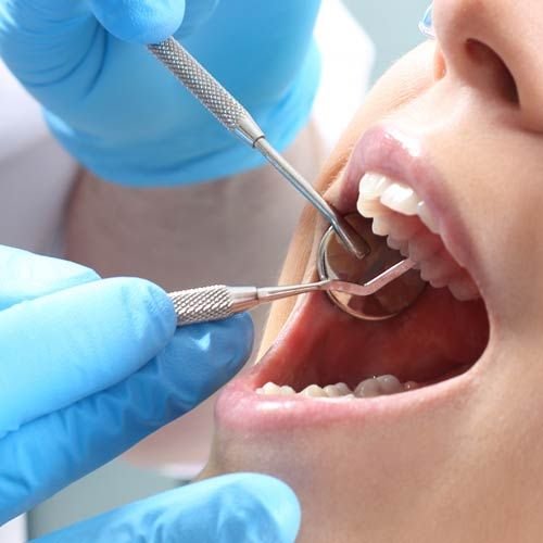 Role of the Teeth: 9 Proven Health Benefits Role of the Teeth Health Benefits