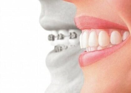Role of the Teeth Health Benefits