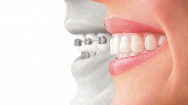 Role of the Teeth Health Benefits
