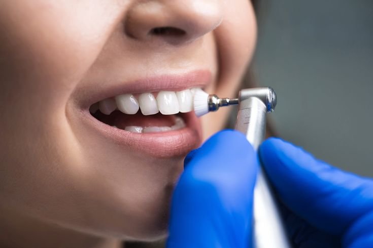Teeth Cleaning Charges Benefits