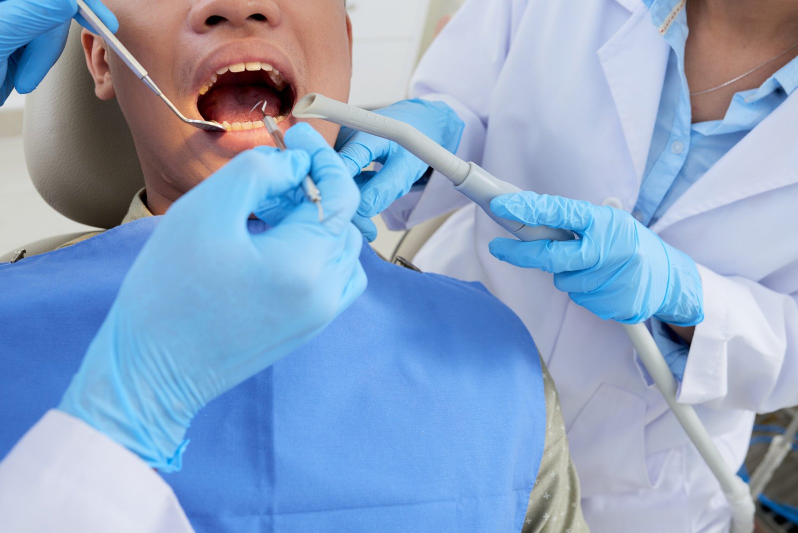 9 Powerful Reasons Root Canal Treatment Saves Teeth Root Canal Treatment