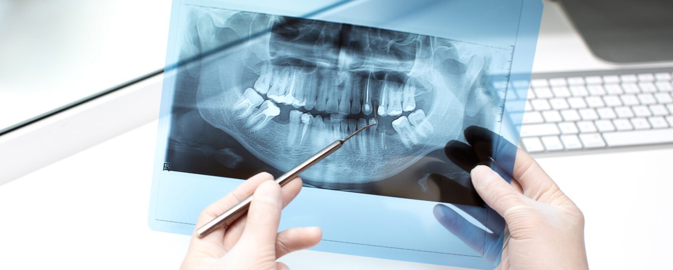 Dental Scanning Benefits