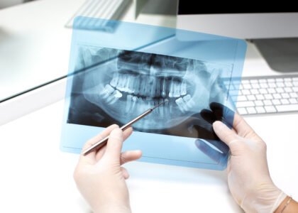 Dental Scanning Benefits