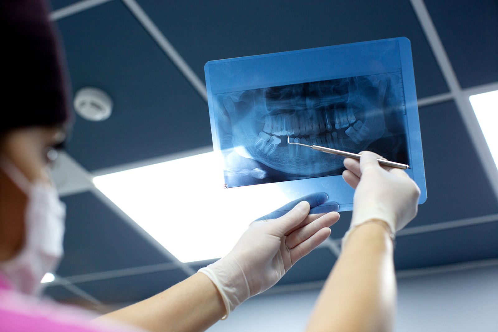 Root Canal Services