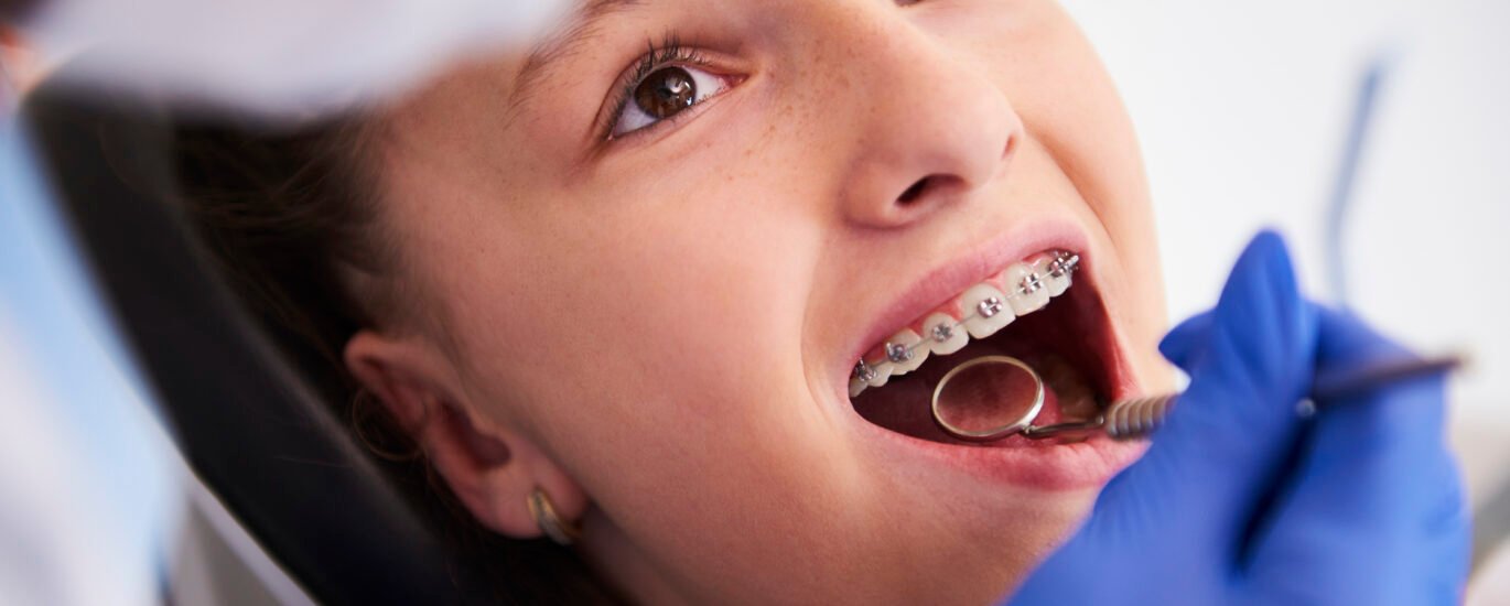 Orthodontic Treatment Smile Solutions