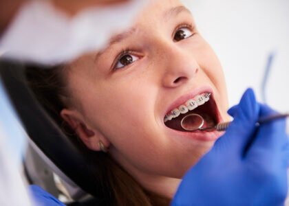 Orthodontic Treatment Smile Solutions