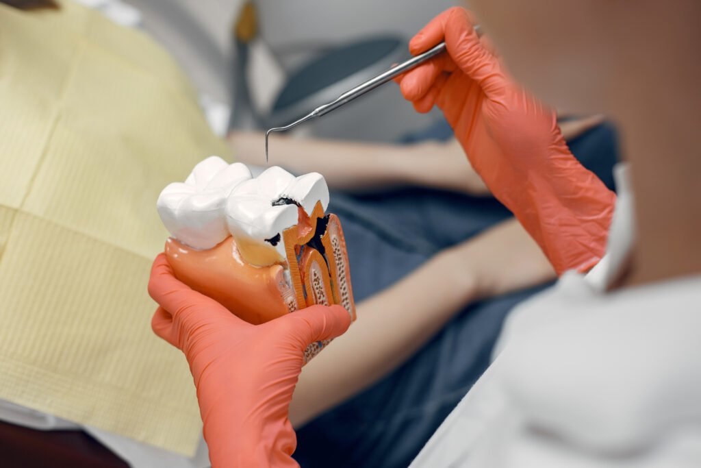 Home Root Canal Treatment