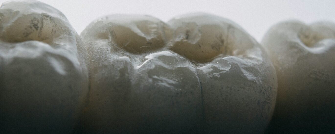 Teeth Diagram Names Explained