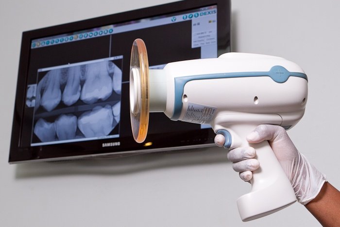 Tooth x ray machine 