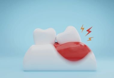 Regrowth Teeth Medicine