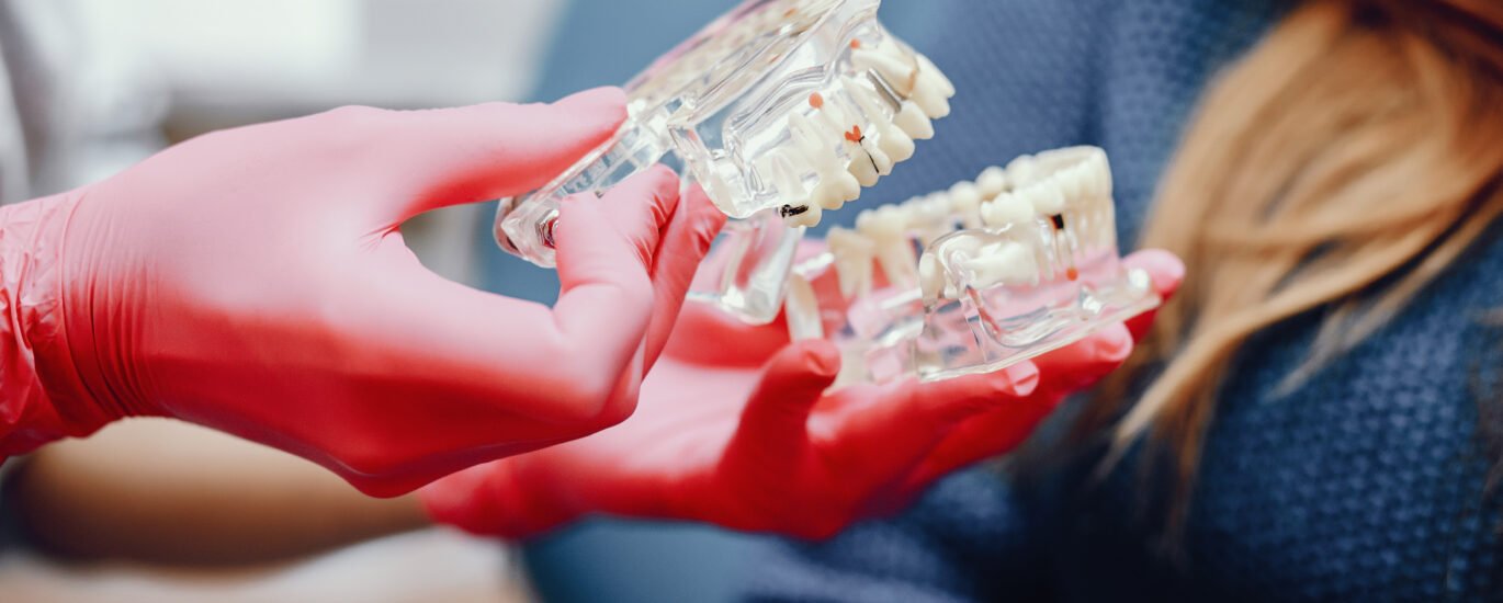 Zirconium Crowns and Bridges