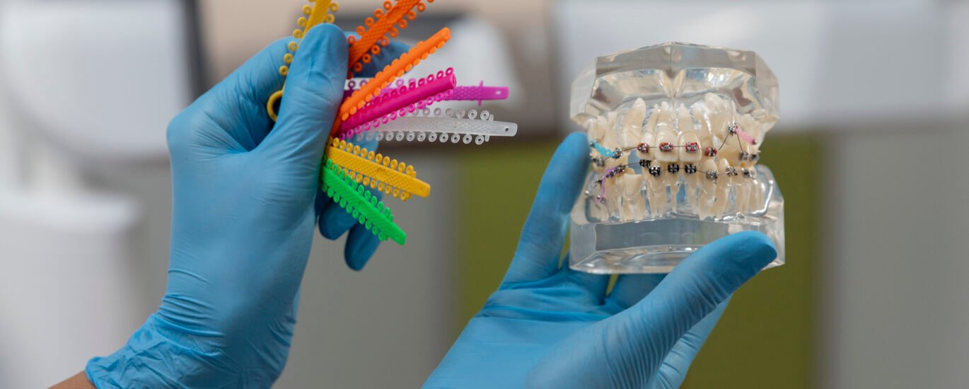 Types of Dental Caps