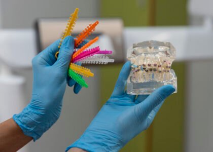 Types of Dental Caps