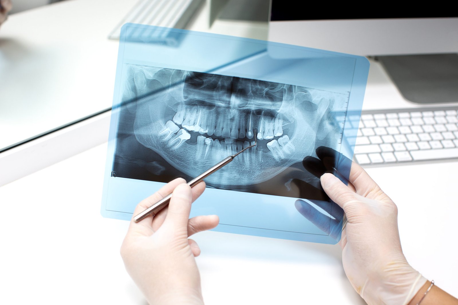 Dental Digital Radiography: 9 Proven Advantages Dental Digital Radiography Advantages